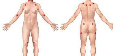 img_como_tratar_la_fibromialgia_5925_600