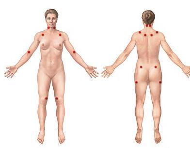 img_como_tratar_la_fibromialgia_5925_600