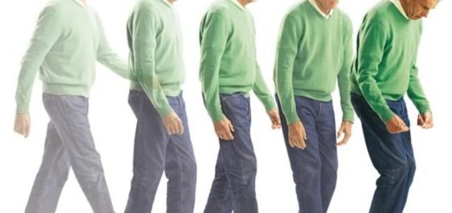 parkinson